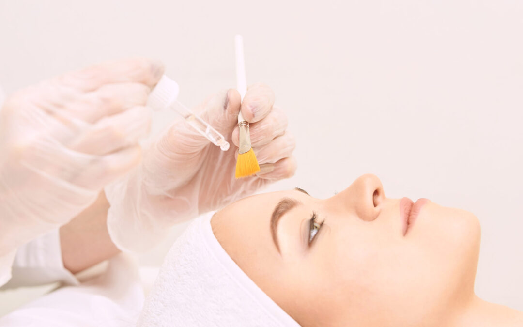 Preparing Your Skin for Spring: Facials and Chemical Peels